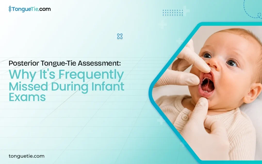 Posterior Tongue-Tie Assessment: Why Function Matters