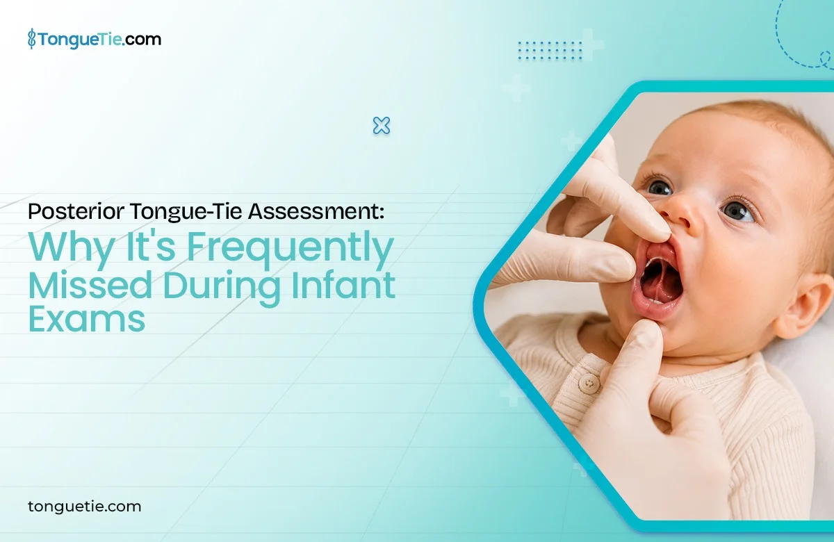 Posterior Tongue-Tie Assessment: Why Function Matters Posterior Tongue-Tie Assessment: Why Function Matters