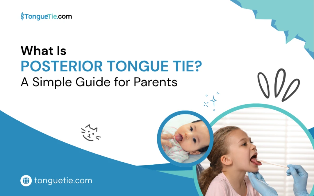 Posterior Tongue Tie Symptoms & Treatment Guide for Parents
