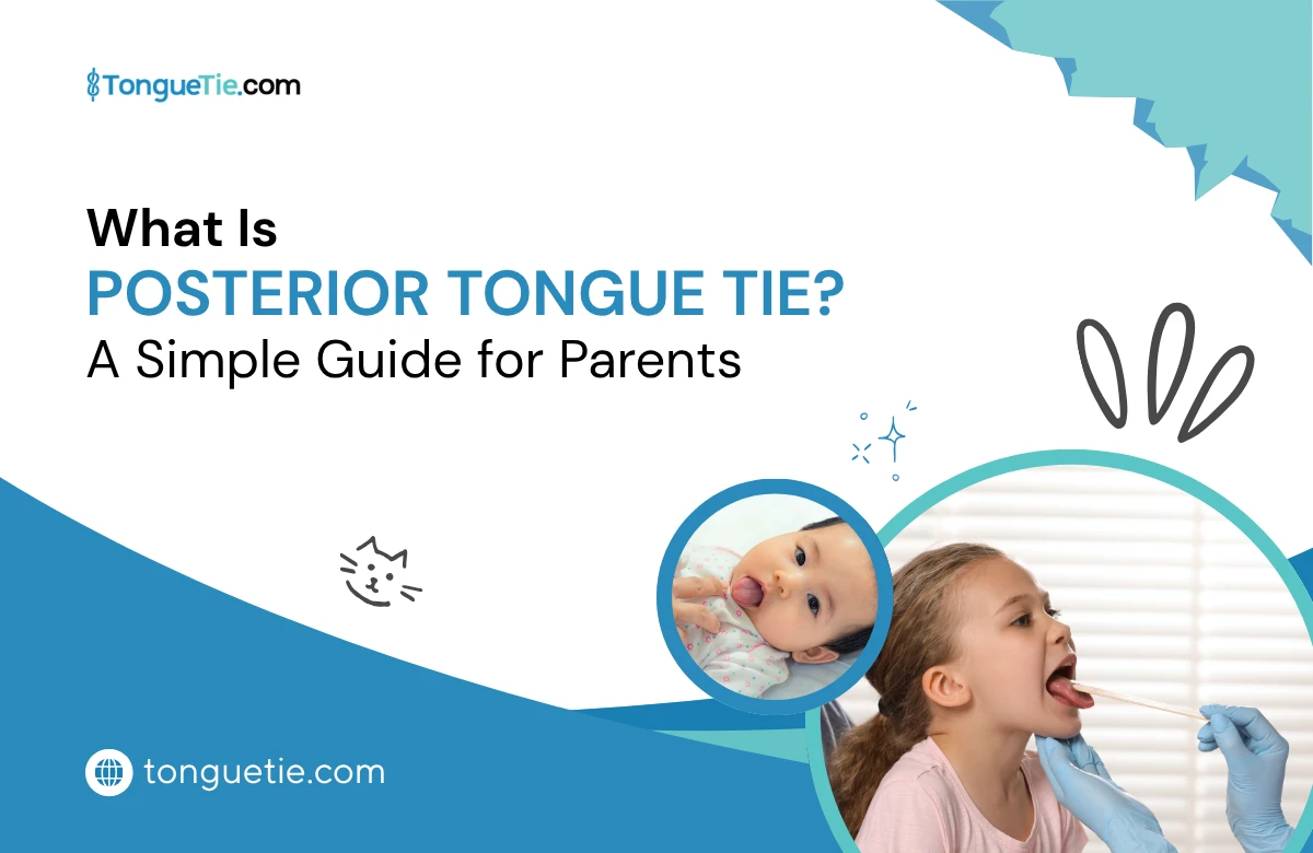 Posterior Tongue Tie Symptoms & Treatment Guide for Parents