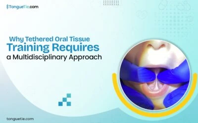 Why Tethered Oral Tissue Training Requires a Multidisciplinary Approach