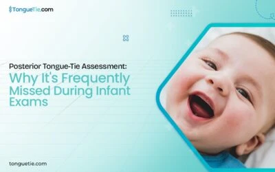 Posterior Tongue-Tie Assessment: Why It’s Frequently Missed During Infant Exams