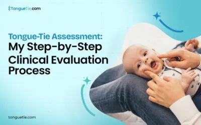 Tongue-Tie Assessment: My Step-by-Step Clinical Evaluation Process