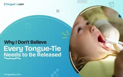 Why I Don’t Believe Every Tongue-Tie Needs to Be Released